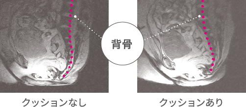 背骨 クッションあり クッションなし